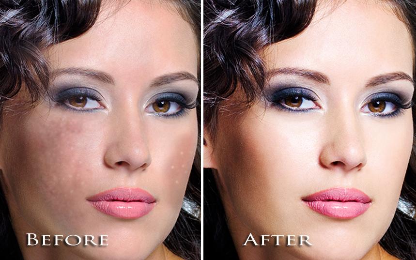 Face Blemishes Removal