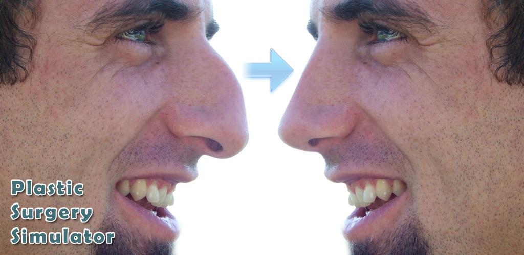 Plastic Surgery Simulator Plastic Surgery Simulator